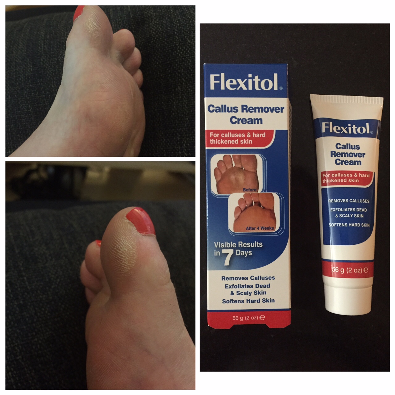 Heel cream deals flexitol